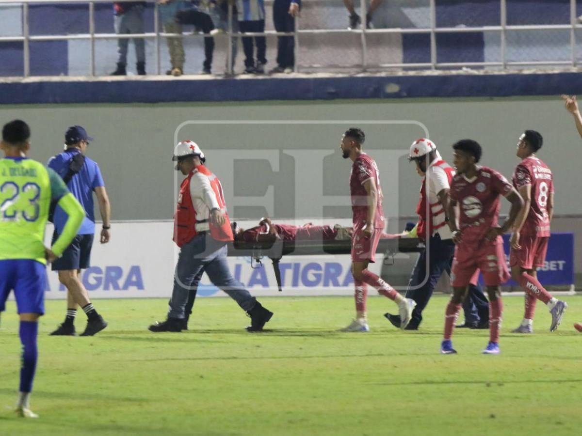 Romario da Silva, futbolista de Motagua, fue intervenido tras su fuerte lesión: ¿volverá a jugar?