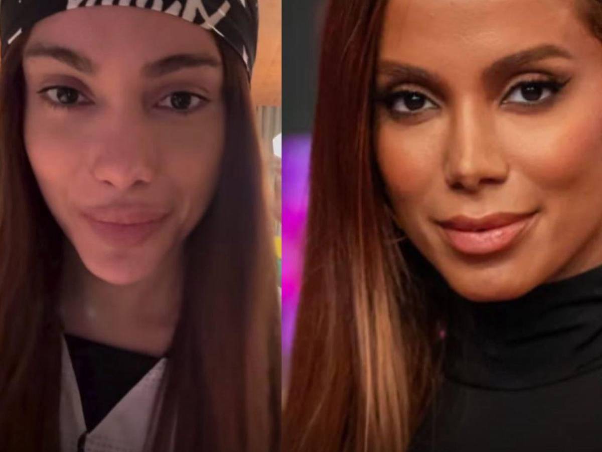 ¿Anitta se sometió a más cirugías? Mi mayor miedo es no reconocerla porque tiene nueva cara