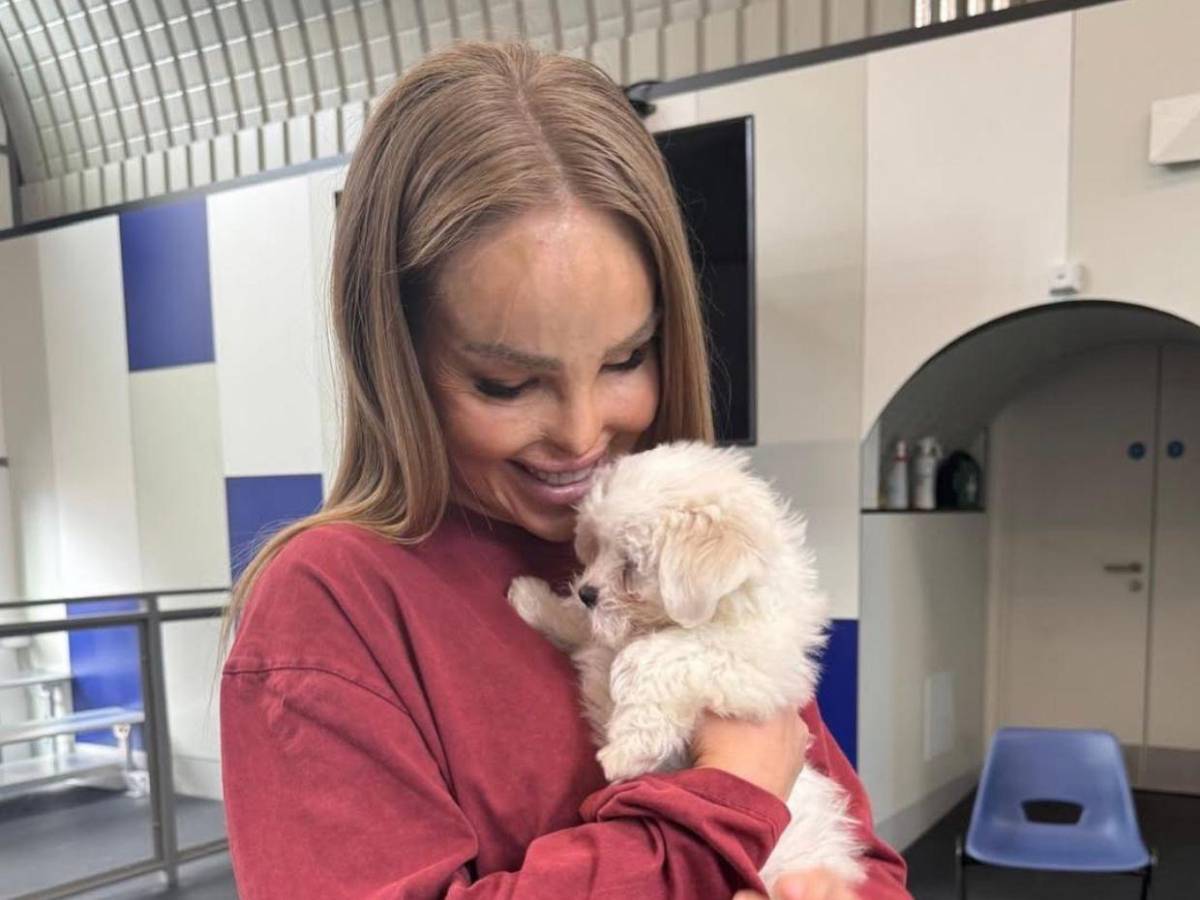 ¿Qué ha sido de Katie Piper, la presentadora a la que le tiraron ácido en la cara?
