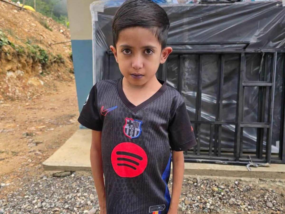 Josué, el niño con el corazón en el lado derecho y cardiopatía; El Salvador  extenderá ayuda