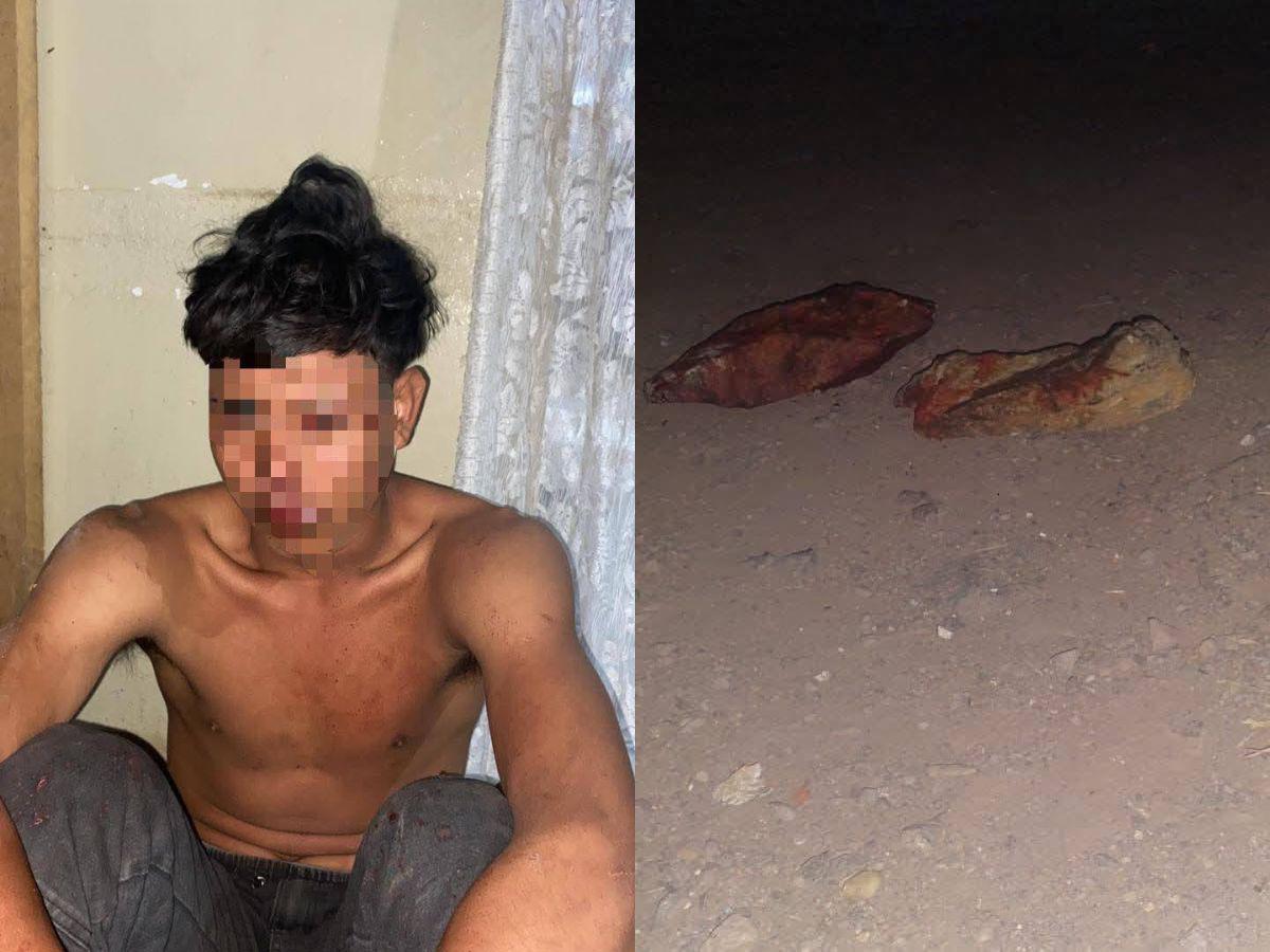 Lo golpeó varias veces en la cabeza: así mataron a pedradas a un hombre en Olancho