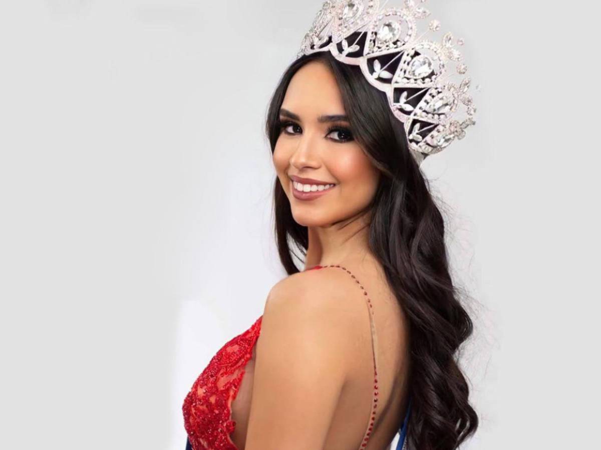 Estaban uno al lado del otro: Skarlent Rodríguez, modelo que murió junto a su pareja tras terremotos en Venezuela