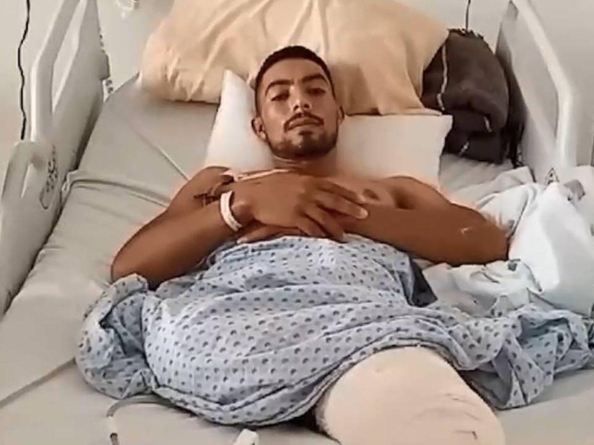 Migrante hondureño hospitalizado tras ser arrollado por tren en México