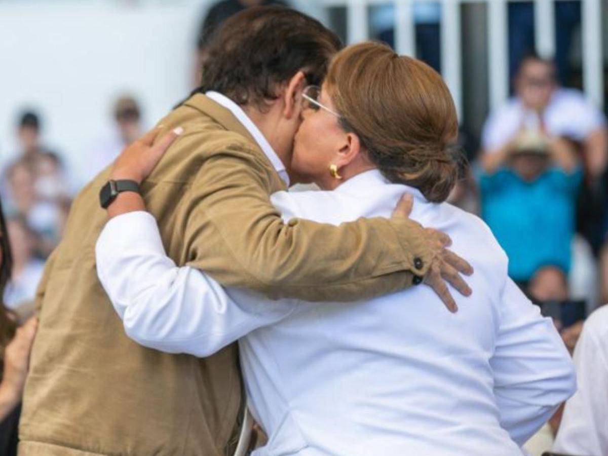Así fue la operación en el corazón a la que se sometió el expresidente Manuel Zelaya