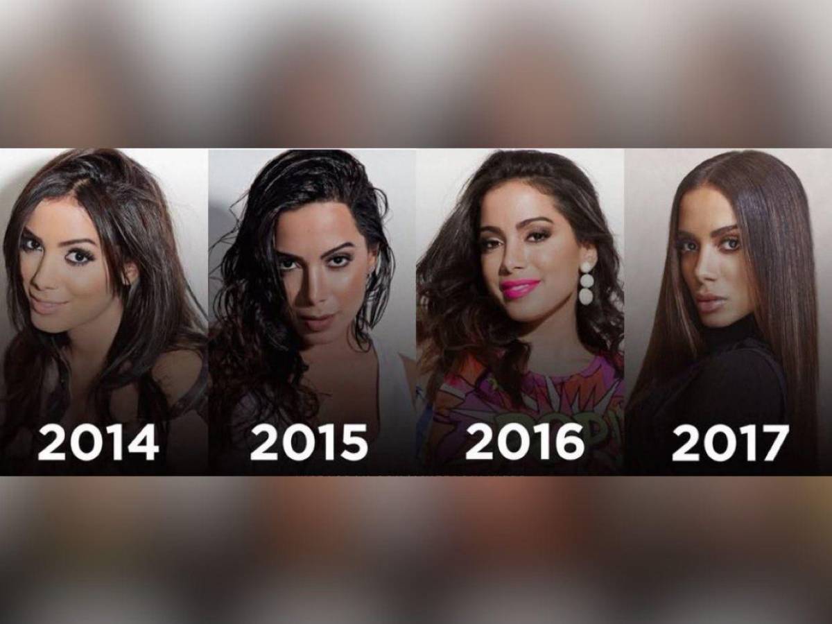 ¿Anitta se sometió a más cirugías? Mi mayor miedo es no reconocerla porque tiene nueva cara