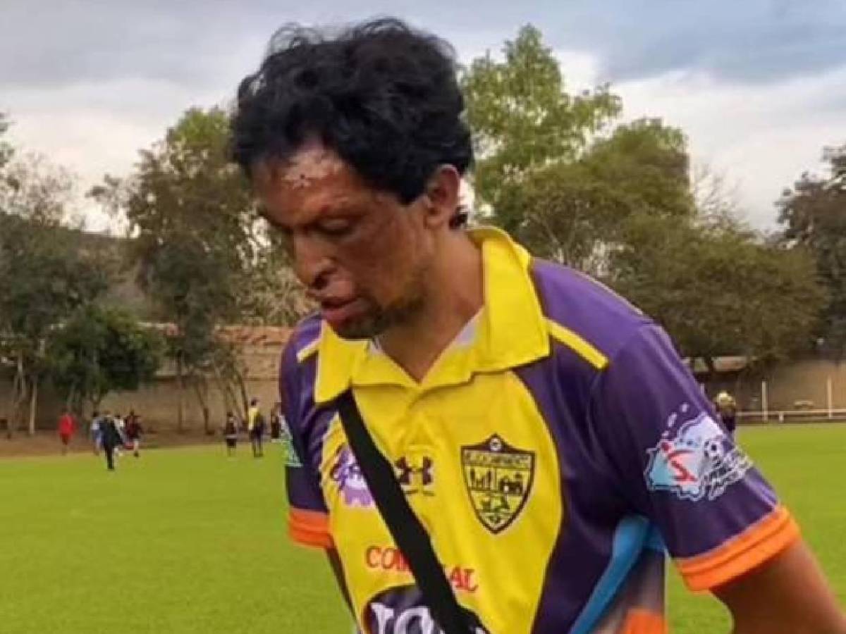 Pedro Joaquín Amador quiere ser convocado a la Selección de Honduras: Las condiciones que puso