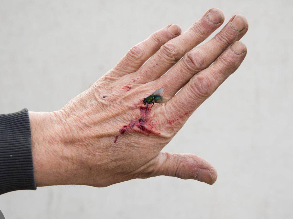 Devorador de hombres, así invade y prolifera en heridas humanas el gusano barrenador