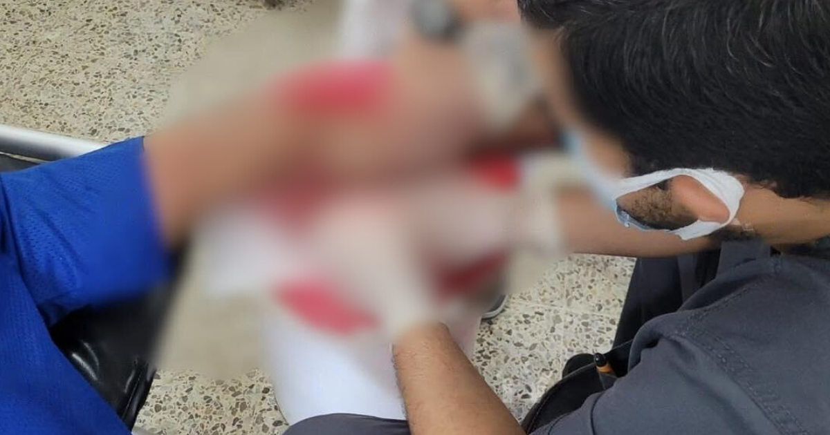 Hombre es hospitalizado tras ser mordido por un cerdo en Olancho