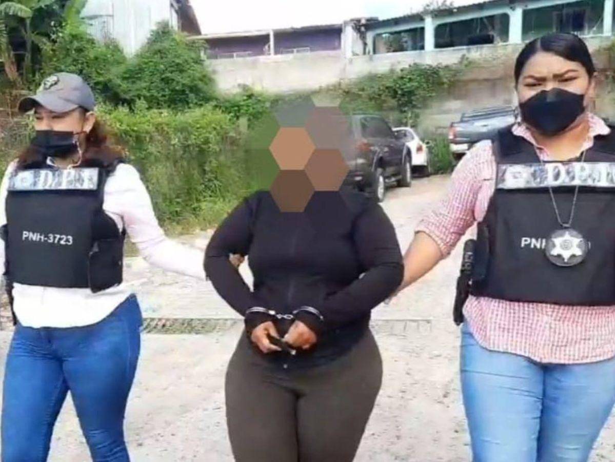 Detienen a una mujer por quemar a su hija de nueve años con una plancha en Tegucigalpa