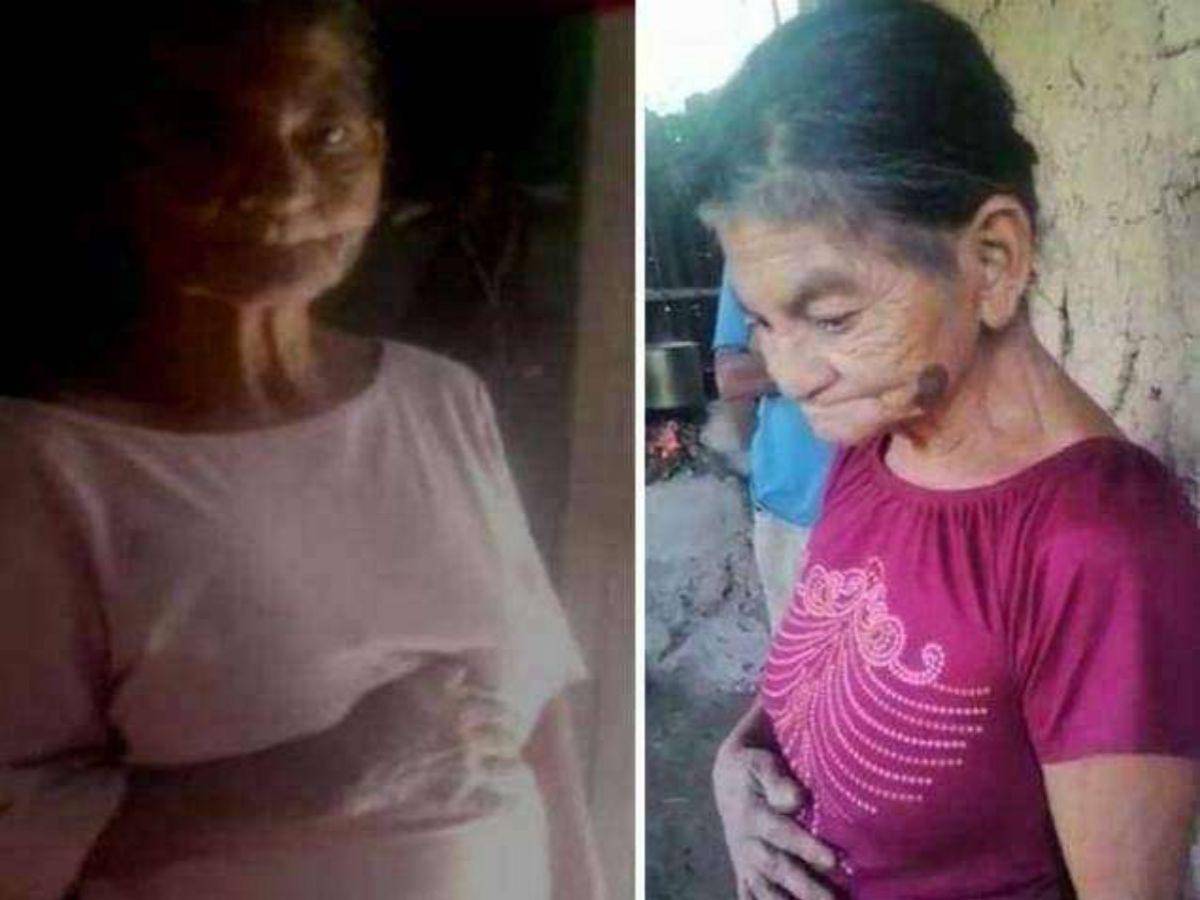 El estado de la mujer desafiaba a la ciencia.