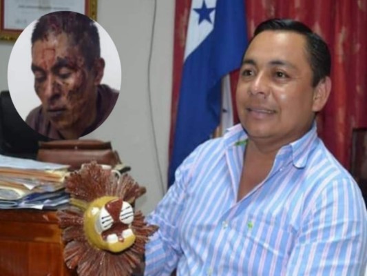 Detención judicial contra presunto asesino de alcalde de Yamaranguila