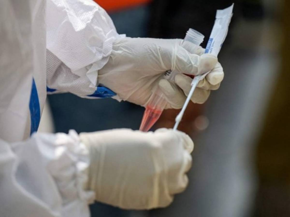 Honduras no estaría exento de flurona, la combinación de covid-19 con virus de la gripe