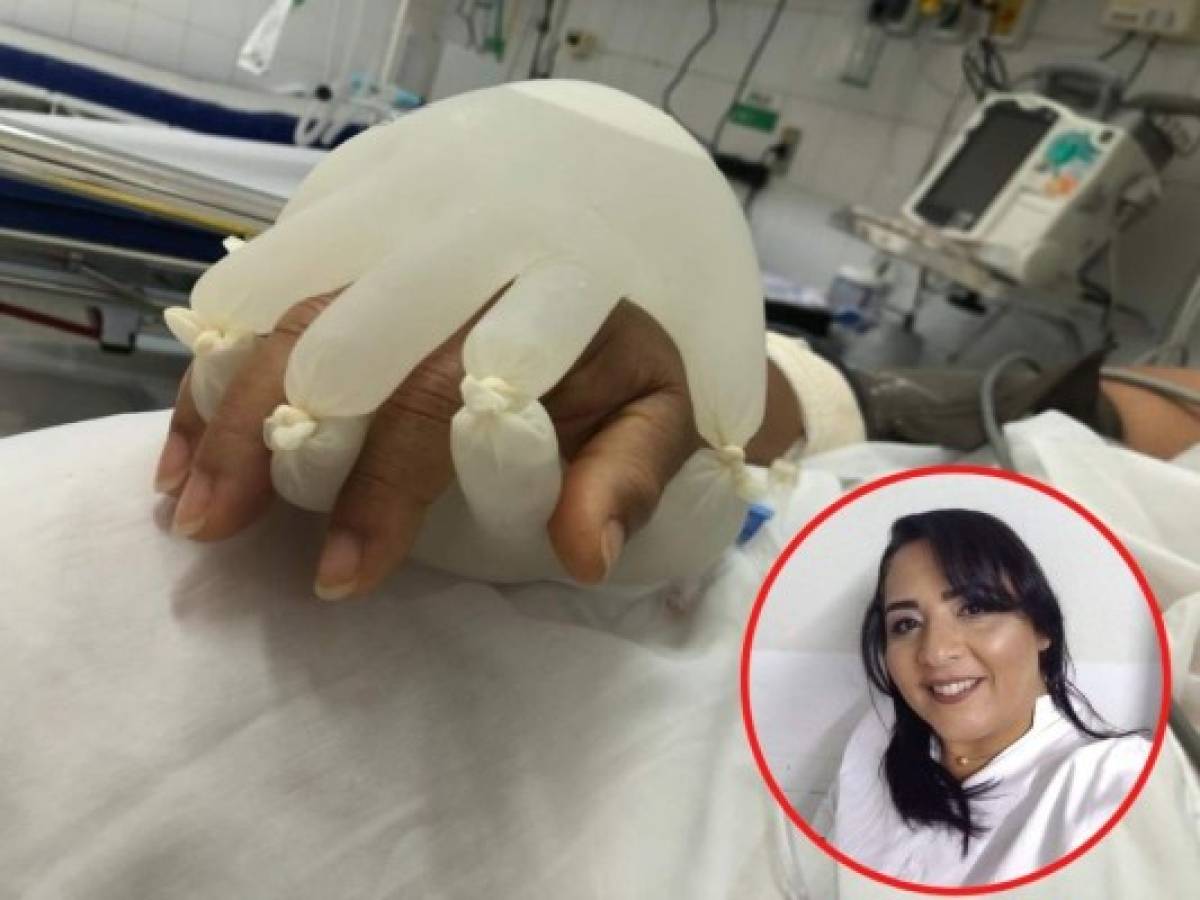 Enfermera crea manos falsas con agua tibia para animar a pacientes de covid-19