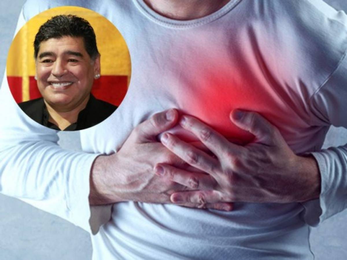 ¿Qué es la miocardiopatía dilatada, la enfermedad que padecía Maradona?