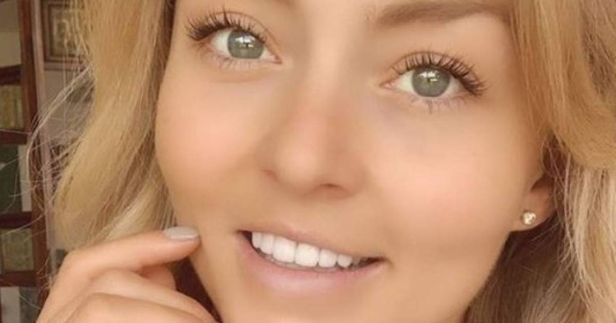 Atriz Angelique Boyer nasceu com o lábio leporino