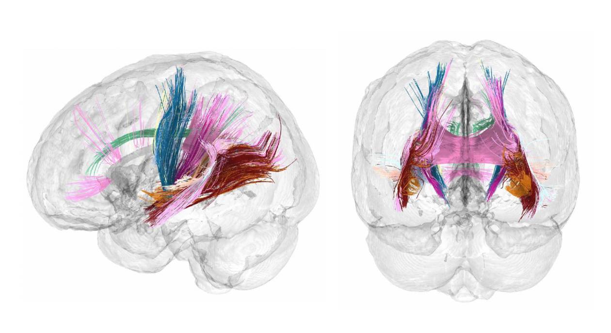 Estudios revelan que el cerebro de las mujeres se transforma durante el embarazo