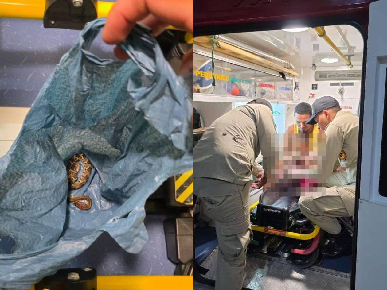 Niña de dos años fue mordida por una serpiente cascabel en Cedros y fue hospitalizada