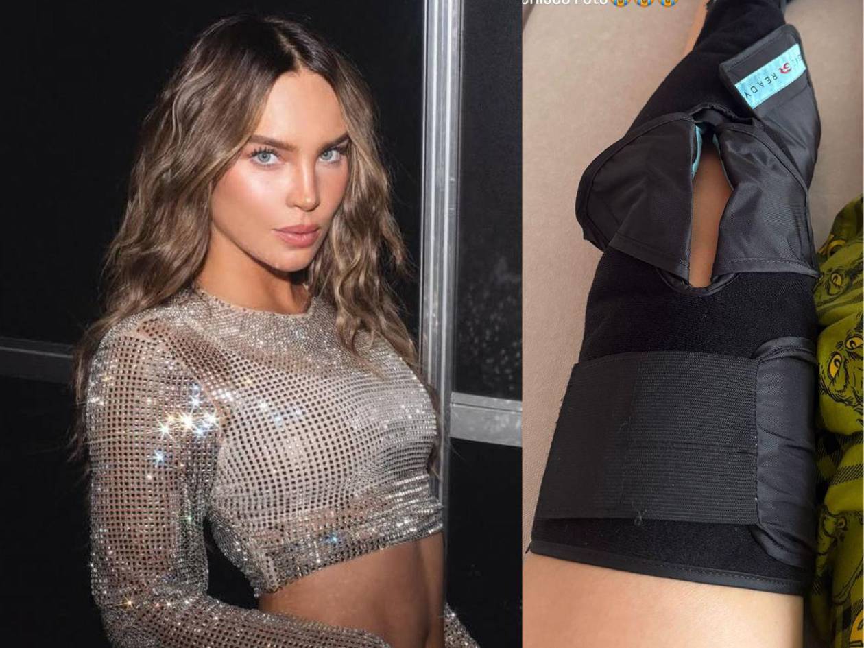 El estado de salud de Belinda tras aparatosa lesión en su rodilla