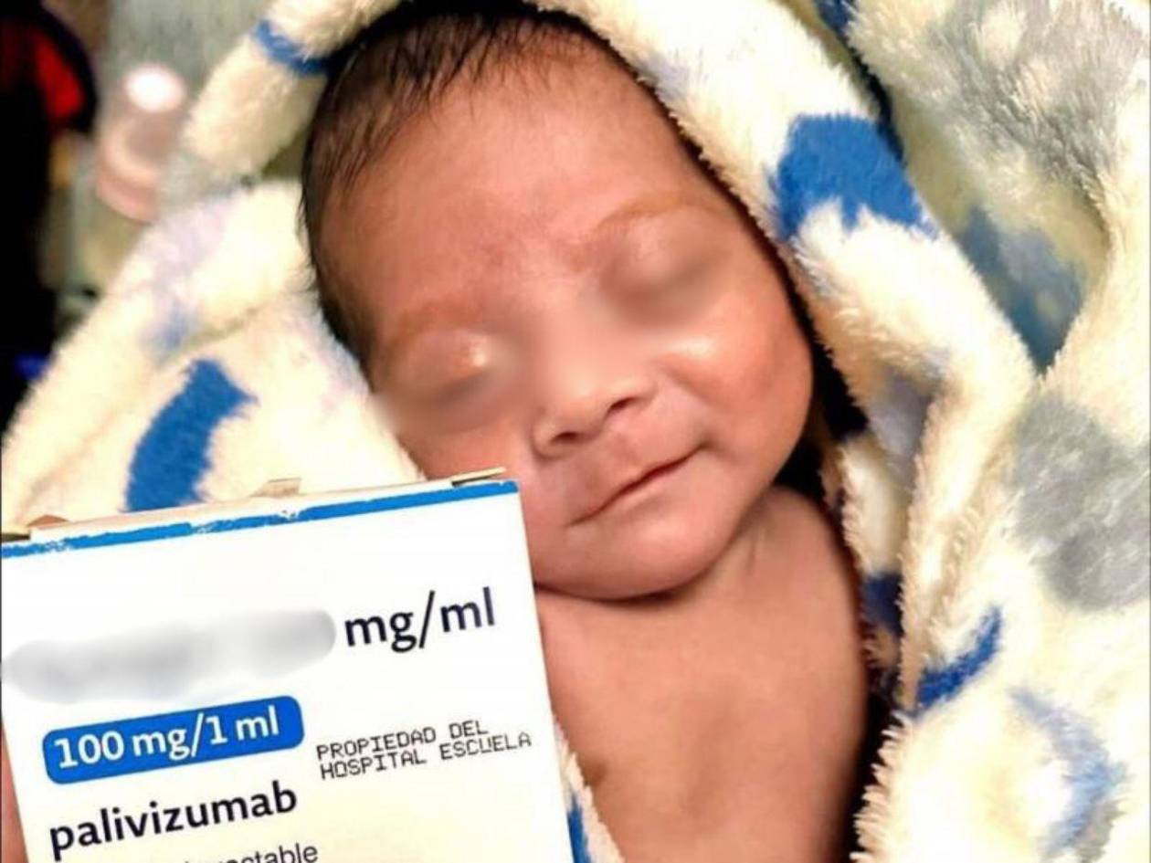Virus Respiratorio Sincitial: una amenaza para los recién nacidos