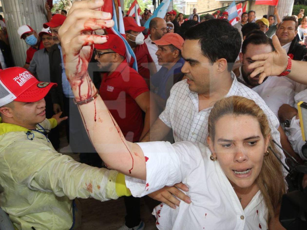 Policías y seguridad del Congreso Nacional agreden a diputados y simpatizantes liberales