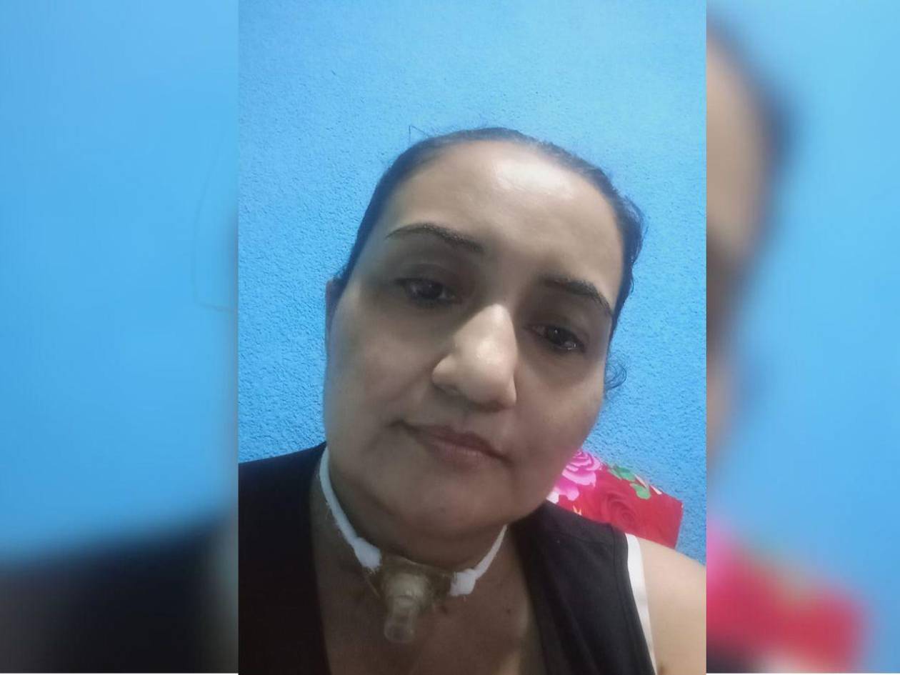 Hondureña solicita apoyo económico para recuperar el habla y respirar con normalidad