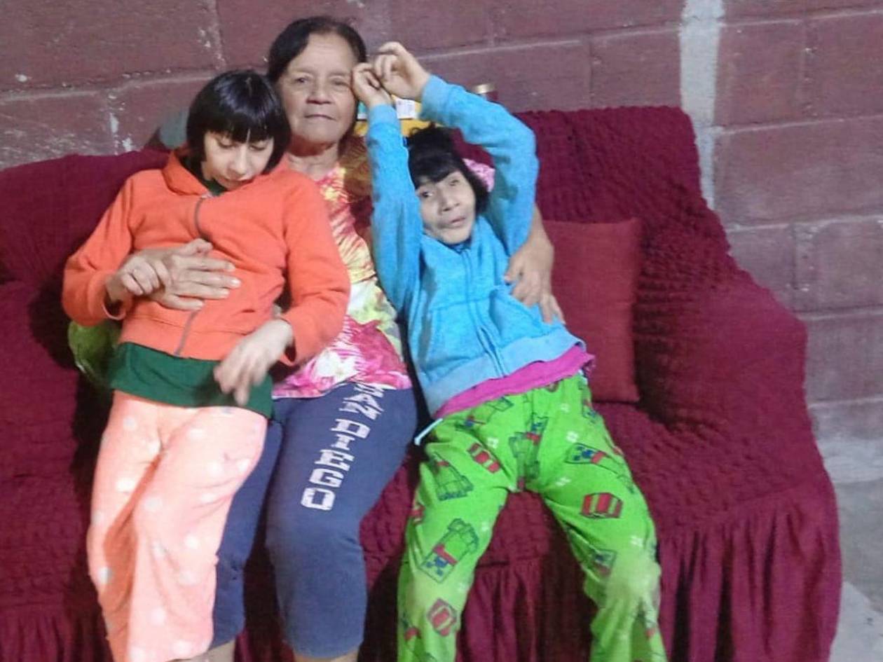 Madre capitalina clama por ayuda para sus dos hijas con microcefalia severa