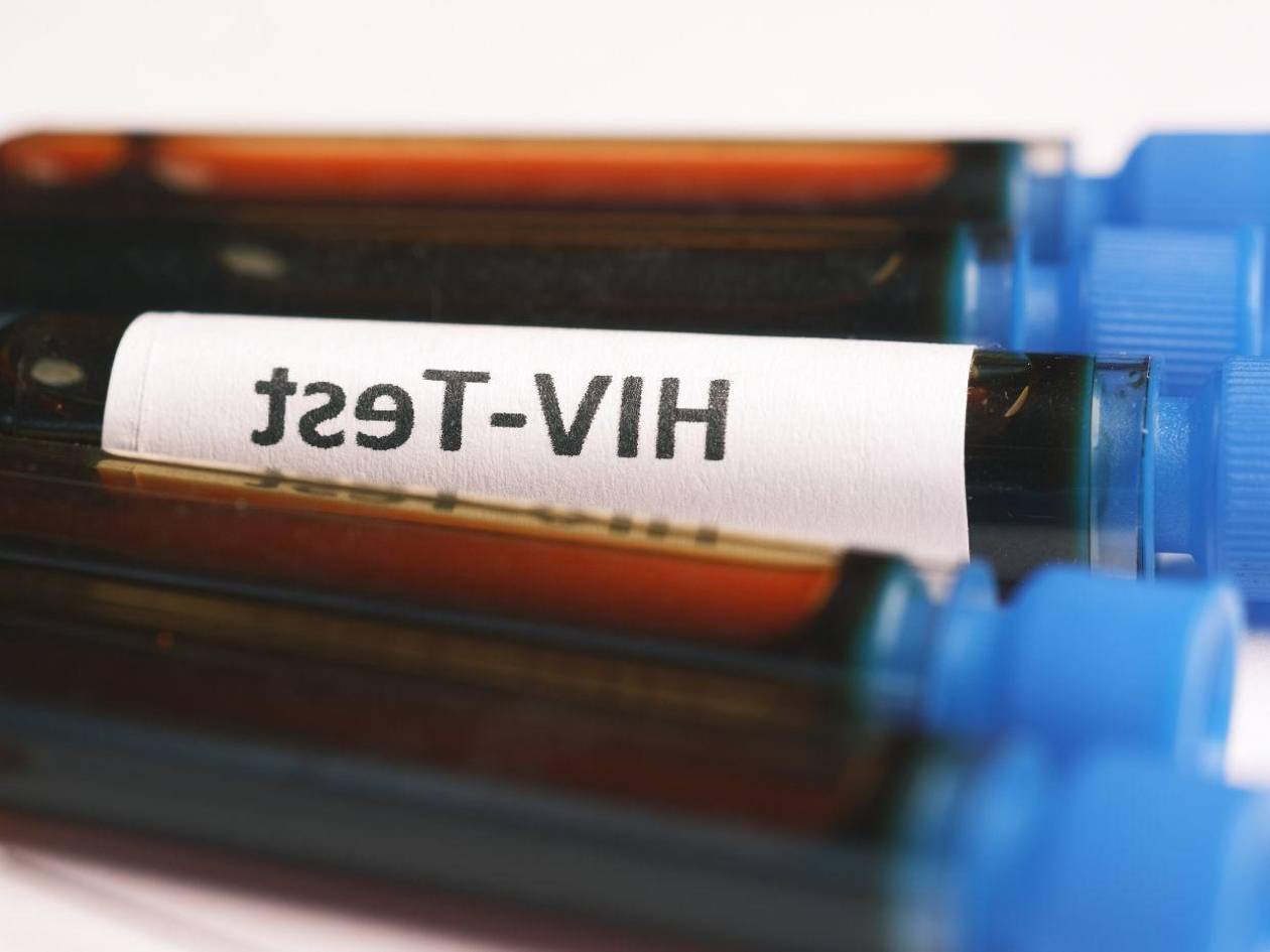 Honduras registra más de mil casos de VIH en lo que va de 2025