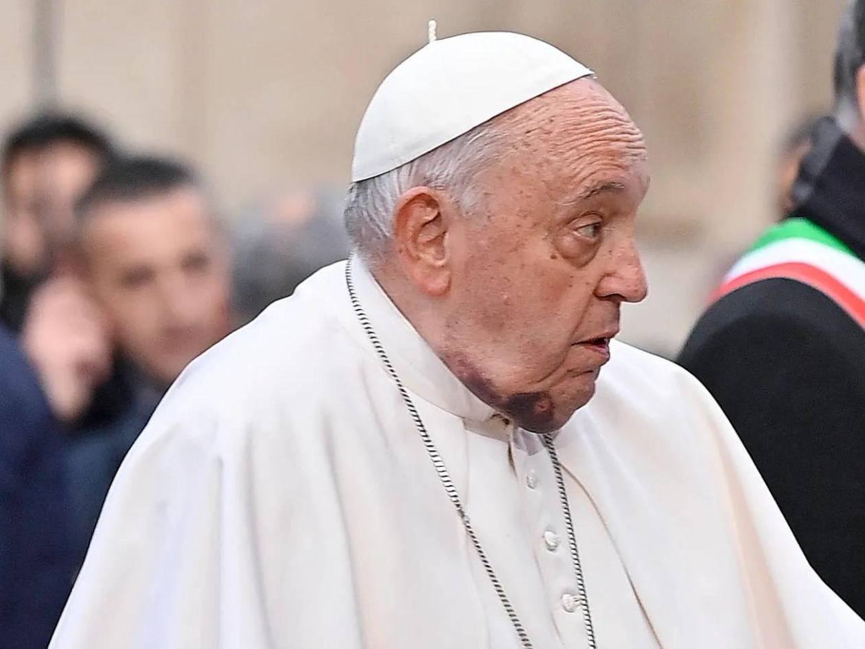 El papa Francisco se mantiene estable en el hospital y recibe visitas clave