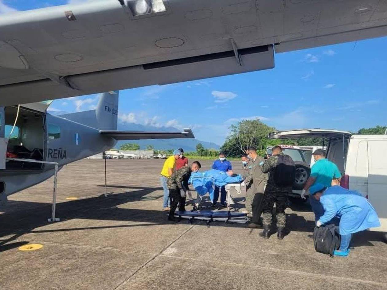 Muere mujer que resultó quemada mientras llenaba un chimbo de gas en La Ceiba