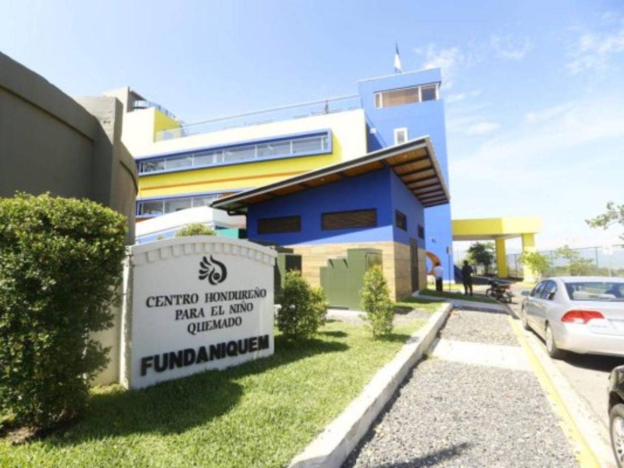 14 niños hospitalizados por quemaduras en sus cuerpos saturan el CEHNIQ