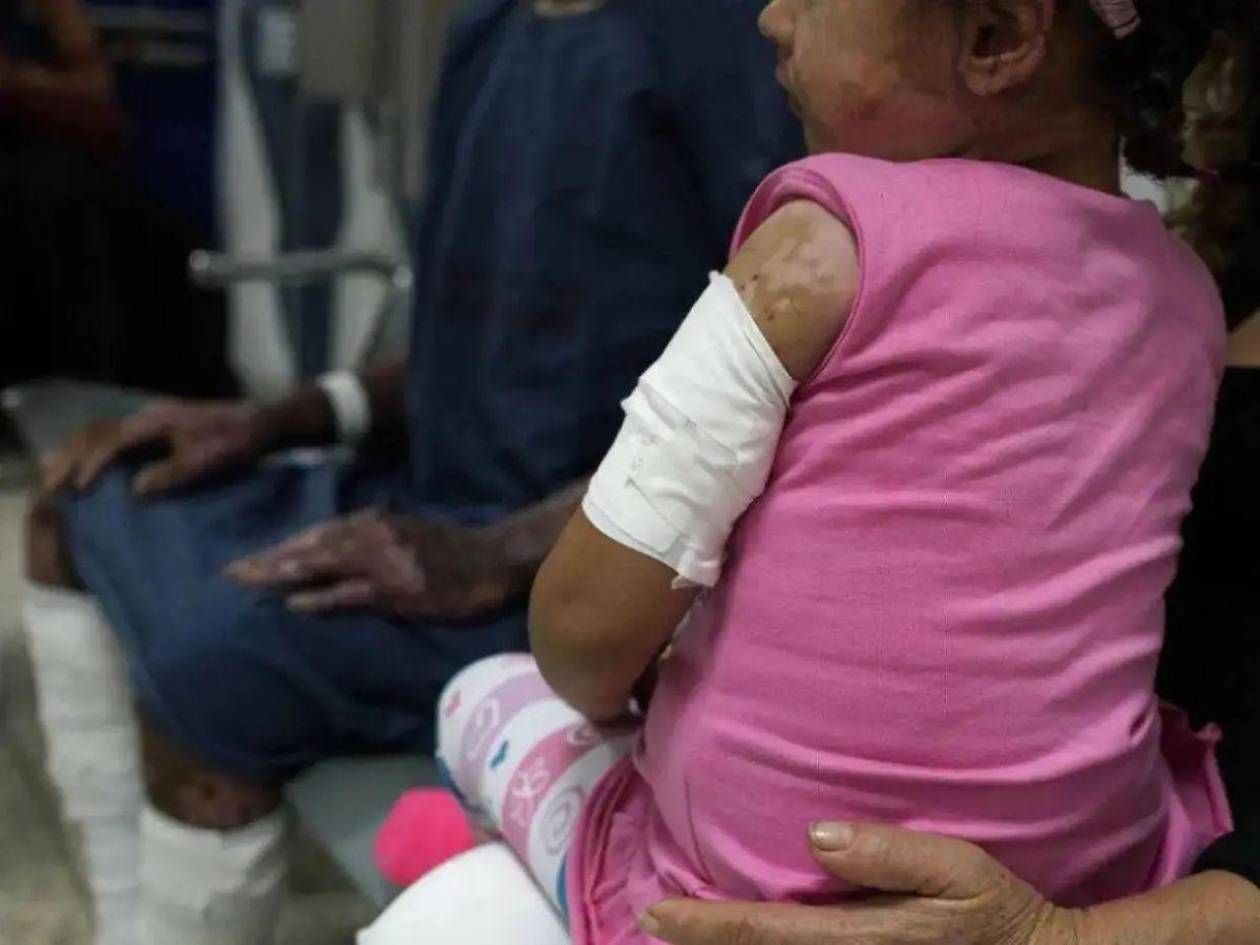 Registran primeros niños con quemaduras por pólvora en San Pedro Sula