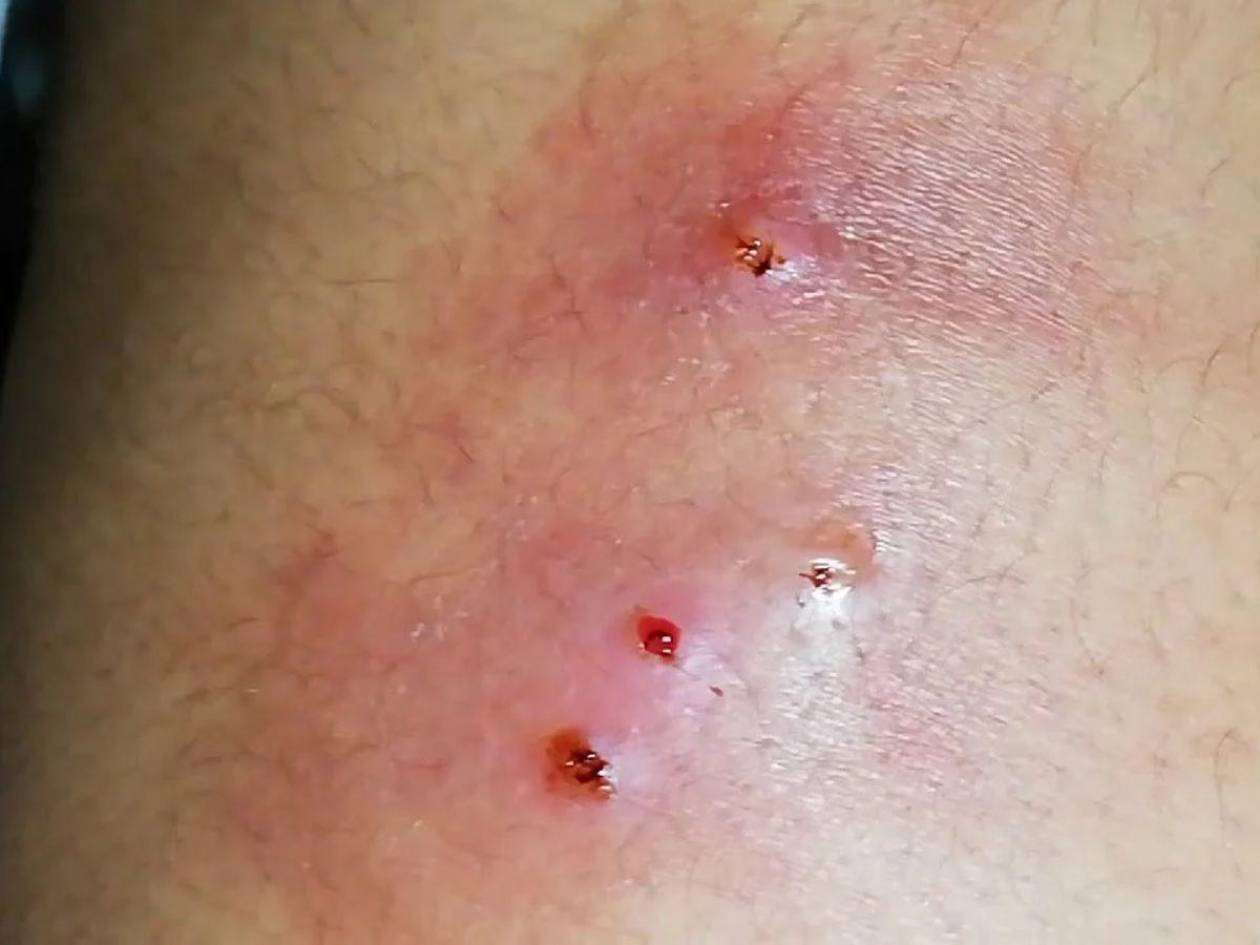 Honduras reporta 27 contagios por miasis, enfermedad transmitida por el gusano barrenador