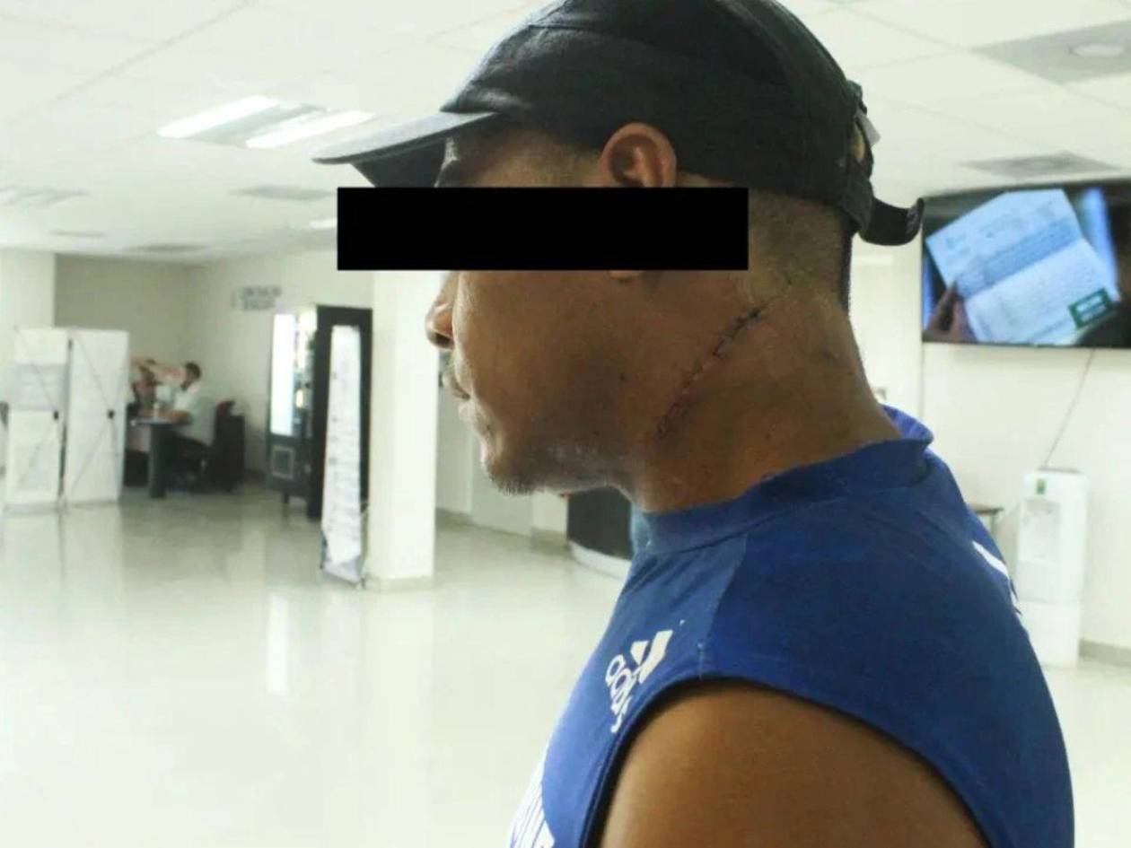 Migrantes hondureños hieren en el cuello a un hombre en Saltillo, México