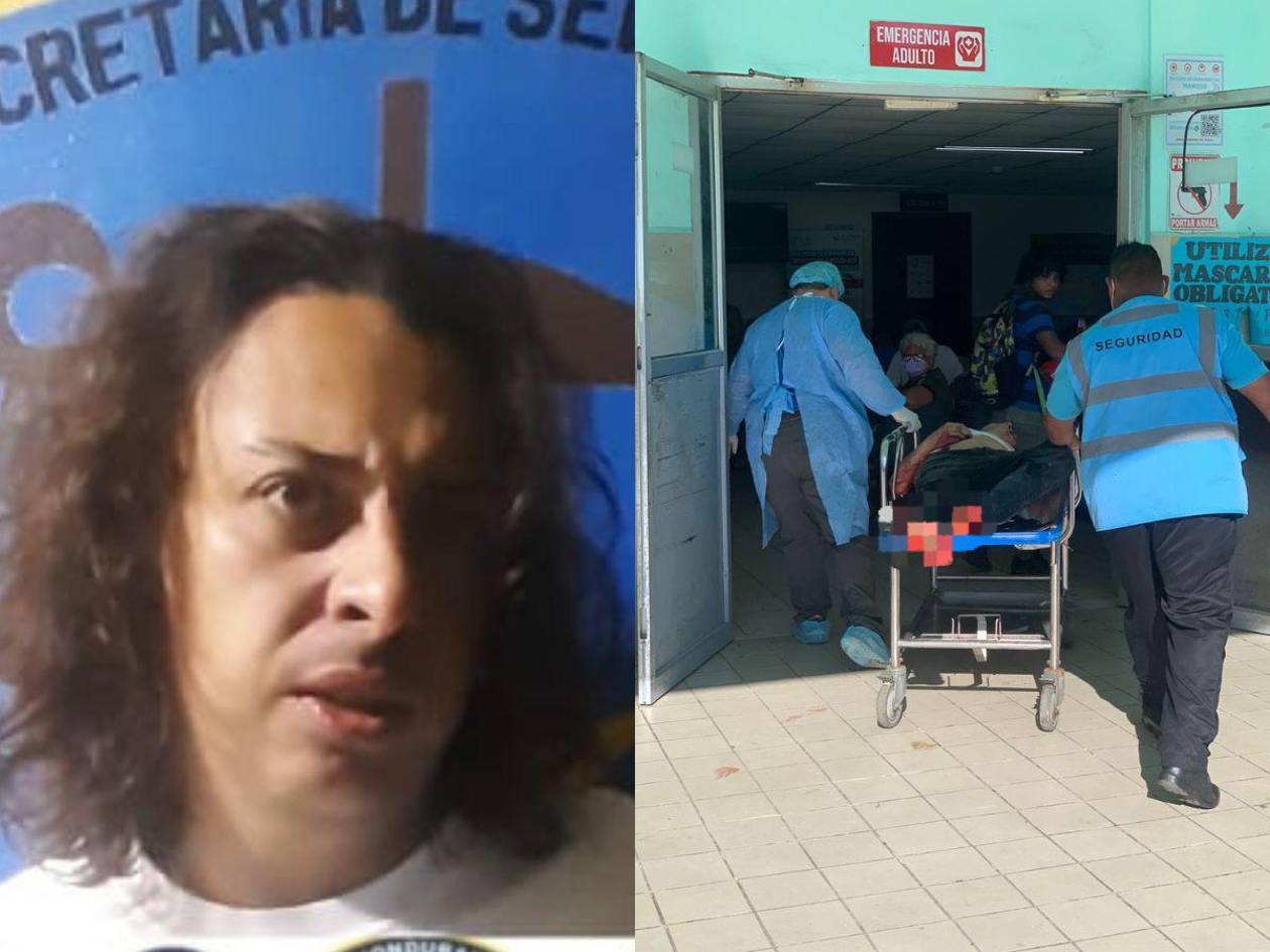 Policía asesinó a detenido en una posta de Atlántida: estaba bajo custodia por posesión de cocaína