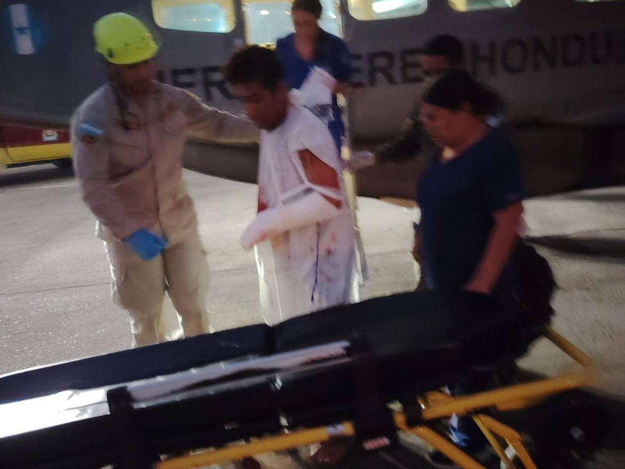 Una lancha le cortó tres dedos a un pescador mientras buscaba caracoles en Roatán