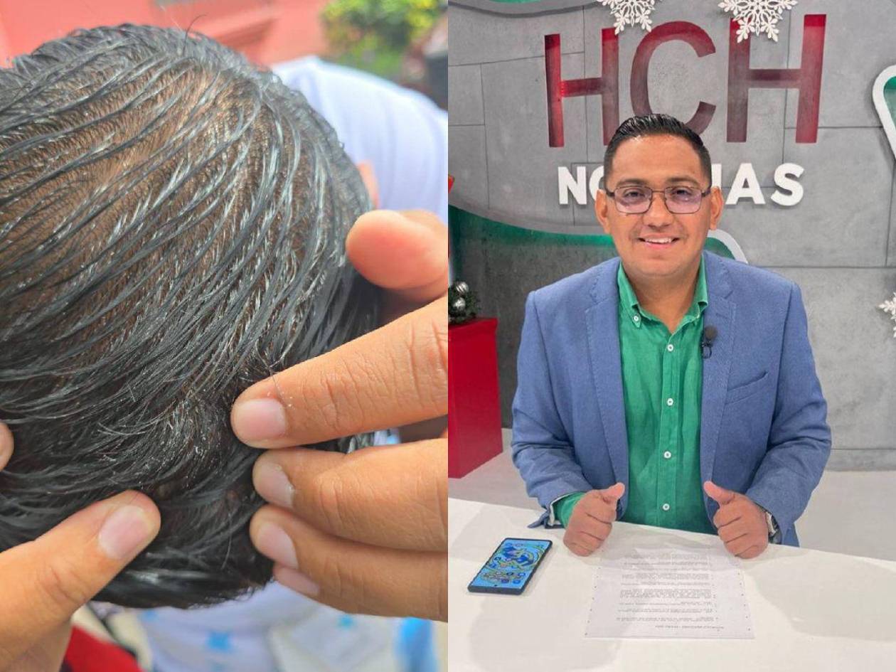 Condenan agresión verbal y con piedras de supuestos colectivos de Libre a periodista Luis Anariba