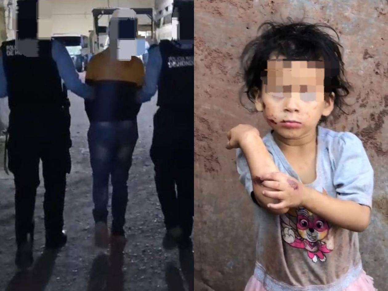 Detienen a joven madre por maltratar a sus hijas de 1 y 3 años en la colonia Villa Delmi