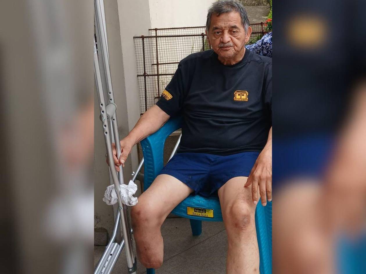 Don Gerardo López necesita una silla de ruedas para recuperar su movilidad