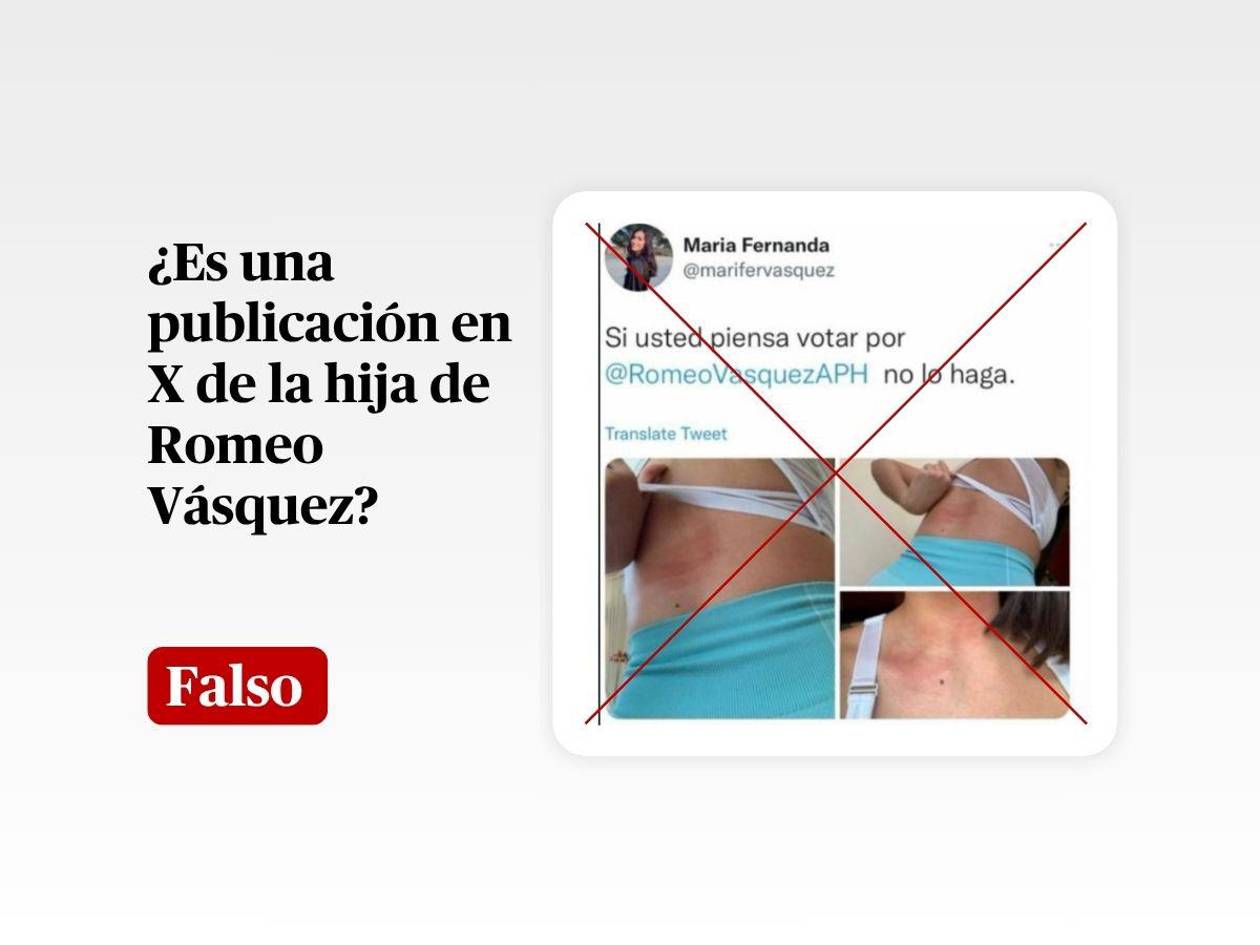 Hija de Romeo Vásquez no publicó en X imágenes con moretones: es una cuenta falsa