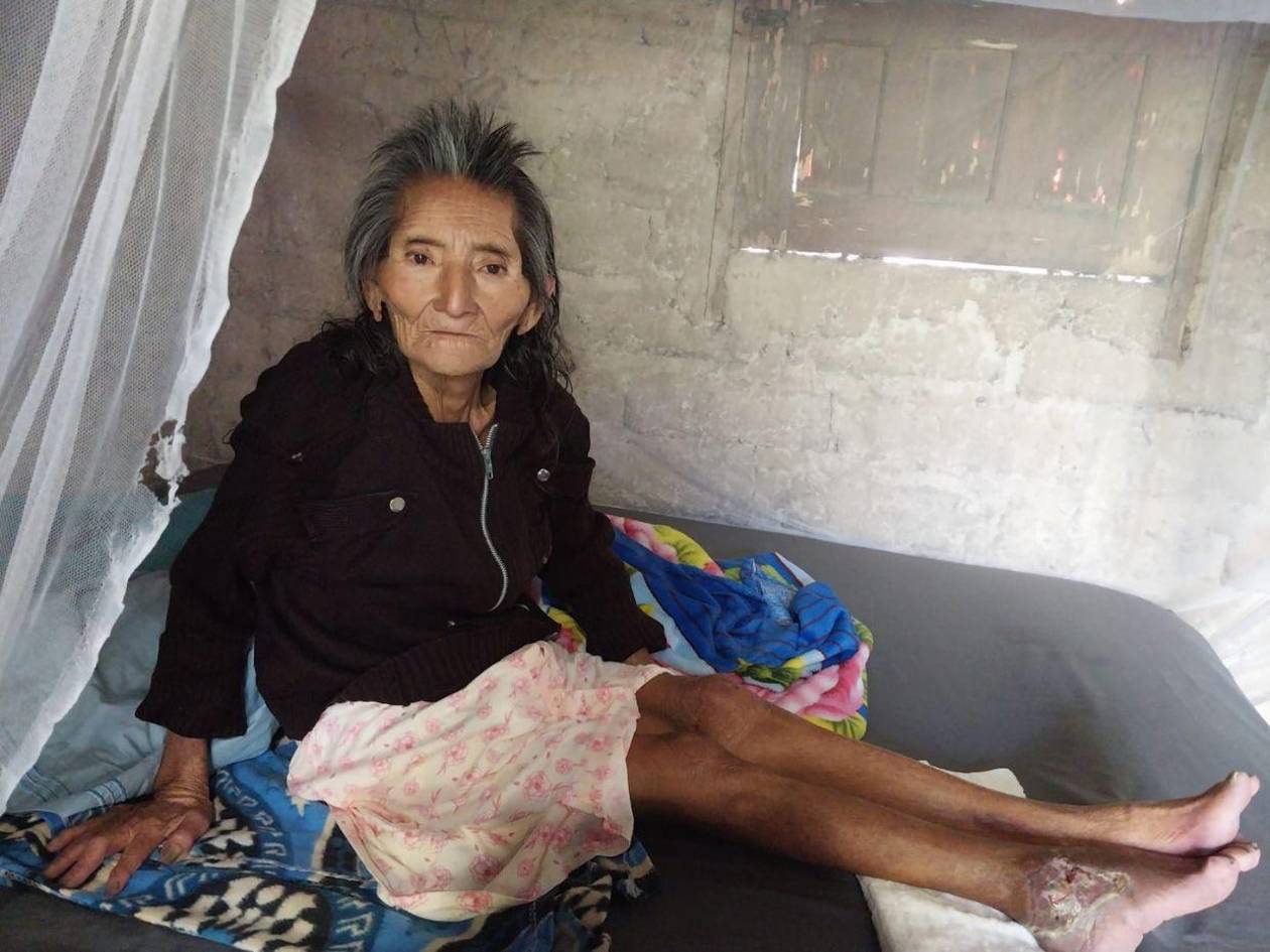 Doña Cristina requiere ayuda para superar infección del gusano barrenador