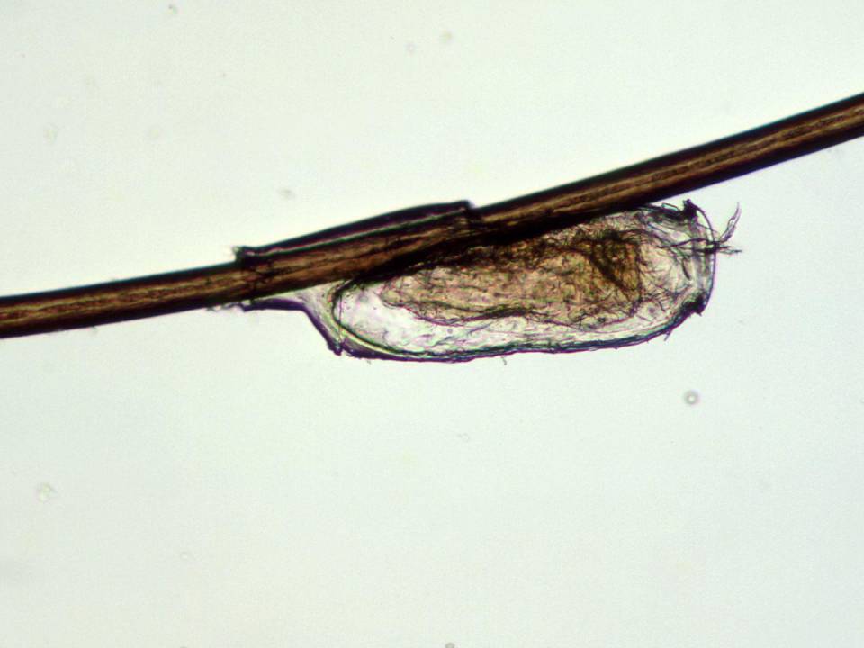 El piojo humano es más cercano a piojos en chimpancés. Un huevecillo de piojo en pelo humano.