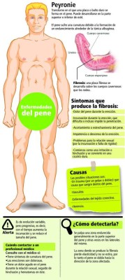 Curvas peligrosas...