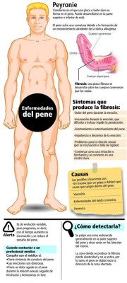 Curvas peligrosas...