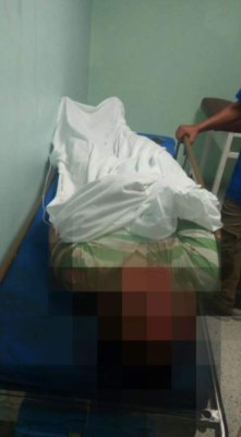 Carro 'fantasma' atropella a cinco personas y se da a la fuga en Nacaome