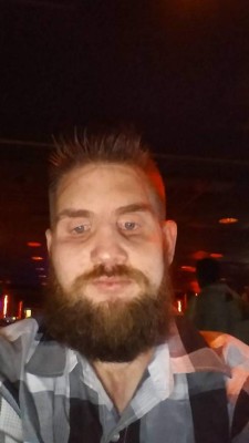 FOTOS: El increíble trasplante de rostro de un soldado