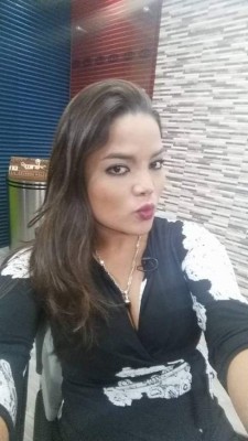 Famosas hondureñas que admitieron públicamente someterse a una cirugía plástica