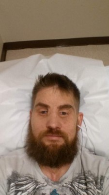 FOTOS: El increíble trasplante de rostro de un soldado