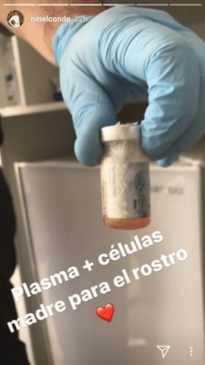 ¡Revelación! Ninel Conde se somete a doloroso tratamiento para estar siempre bella