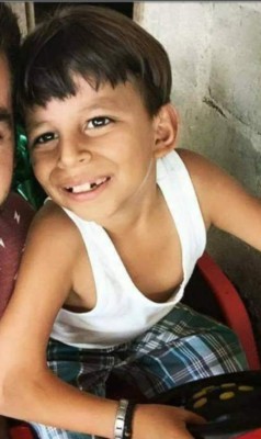 El sorprendente cambio físico del hondureño Marlon Yasir, tras varias cirugías y tratamientos (FOTOS)