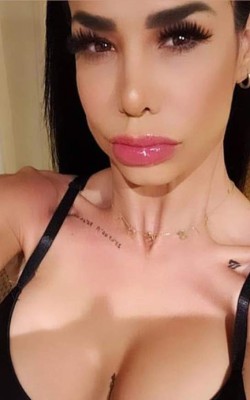 FOTOS: Lis Vega y su radical transformación física tras varias cirugías